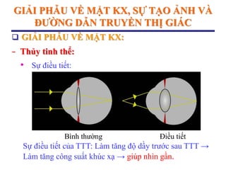 GIẢI PHẪU VỀ MẶT KX, SỰ TẠO ẢNH VÀ
ĐƢỜNG DẪN TRUYỀN THỊ GIÁC
 GIẢI PHẪU VỀ MẶT KX:
− Thủy tinh thể:
• Sự điều tiết:
Sự điều tiết của TTT: Làm tăng độ dầy trước sau TTT →
Làm tăng công suất khúc xạ → giúp nhìn gần.
Bình thường Điều tiết
 