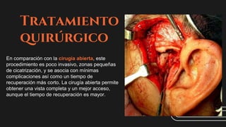 Tratamiento
quirúrgico
En comparación con la cirugía abierta, este
procedimiento es poco invasivo, zonas pequeñas
de cicatrización, y se asocia con mínimas
complicaciones así como un tiempo de
recuperación más corto. La cirugía abierta permite
obtener una vista completa y un mejor acceso,
aunque el tiempo de recuperación es mayor.
 