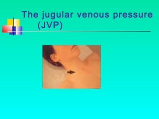 [Int. med] jugular venous pressure from SIMS Lahore | PPT