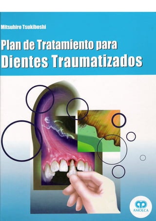 Plan de tx para dientes traumatizados