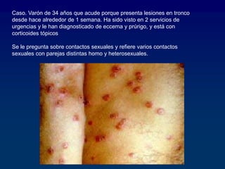 Caso. Varón de 34 años que acude porque presenta lesiones en tronco
desde hace alrededor de 1 semana. Ha sido visto en 2 servicios de
urgencias y le han diagnosticado de eccema y prúrigo, y está con
corticoides tópicos
Se le pregunta sobre contactos sexuales y refiere varios contactos
sexuales con parejas distintas homo y heterosexuales.
 