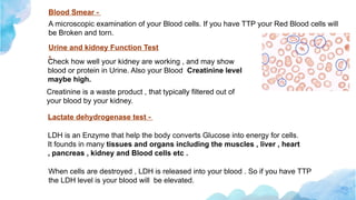 Thrombotic thrombocytopenia purpura .pptx