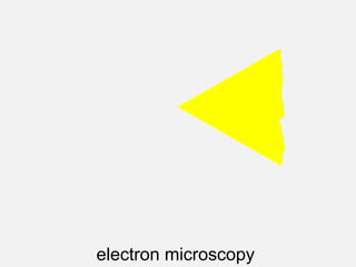 electron microscopy
 