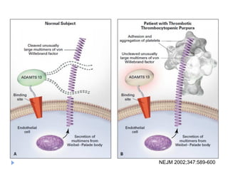 NEJM 2002;347:589-600
 