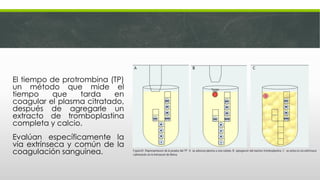 Ttp y tp | PDF