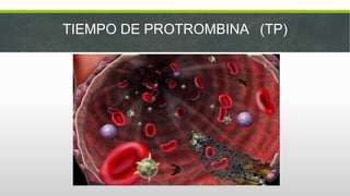 Ttp y tp | PDF