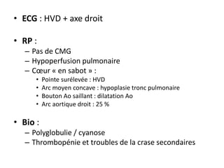 • ECG : HVD + axe droit
• RP :
– Pas de CMG
– Hypoperfusion pulmonaire
– Cœur « en sabot » :
• Pointe surélevée : HVD
• Arc moyen concave : hypoplasie tronc pulmonaire
• Bouton Ao saillant : dilatation Ao
• Arc aortique droit : 25 %
• Bio :
– Polyglobulie / cyanose
– Thrombopénie et troubles de la crase secondaires
 