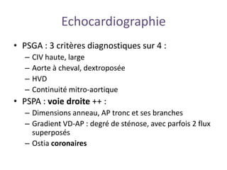 Echocardiographie
• PSGA : 3 critères diagnostiques sur 4 :
– CIV haute, large
– Aorte à cheval, dextroposée
– HVD
– Continuité mitro-aortique
• PSPA : voie droite ++ :
– Dimensions anneau, AP tronc et ses branches
– Gradient VD-AP : degré de sténose, avec parfois 2 flux
superposés
– Ostia coronaires
 
