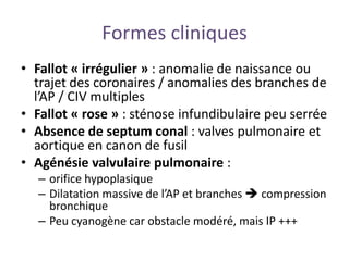 Formes cliniques
• Fallot « irrégulier » : anomalie de naissance ou
trajet des coronaires / anomalies des branches de
l’AP / CIV multiples
• Fallot « rose » : sténose infundibulaire peu serrée
• Absence de septum conal : valves pulmonaire et
aortique en canon de fusil
• Agénésie valvulaire pulmonaire :
– orifice hypoplasique
– Dilatation massive de l’AP et branches  compression
bronchique
– Peu cyanogène car obstacle modéré, mais IP +++
 