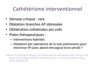 Cathétérisme interventionnel
• Sténose critique : rare
• Dilatation branches AP sténosées
• Oblitération collatérales par coils
• Pistes thérapeutiques :
– Interventions hybrides
– Dilatation per-opératoire de la voie pulmonaire pour
minimiser IP (avec abord chirurgical trans-atrial) ?
Vida et al. Evolving strategies for preserving the pulmonary valve during early
repair of tetralogy of Fallot: Mid-term results. J Thorac Cardiovasc Surg
2014;147:687-96
 