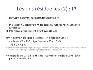 Lésions résiduelles (2) : IP
• 60 % des patients, par patch transannulaire
• Dilatation VD : dyspnée  troubles du rythme  insuffisance
cardiaque
 Intervenir précocement avant symptômes
IRM = examen-clé : pas de régression dilatation VD si :
- volume VD > 150 mL/m² (systo > 95 mL/m²)
- FE VD < 40 %
Buechel and al. Remodelling of the right ventricle after early pulmonary valve replacement
in children with repaired tetralogy of Fallot. Eur Heart J 2005;26:2721-7
Homogreffe ou par cathétérisme interventionnel (Melody) : 15 %
patients revalvulés
 