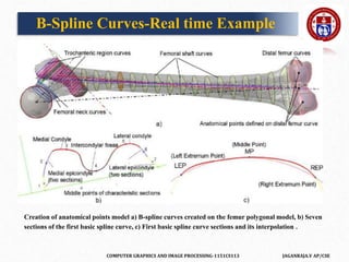 COMPUTER GRAPHICS AND IMAGE PROCESSING-1151CS113 JAGANRAJA.V AP/CSE
B-Spline Curves-Real time Example
Creation of anatomical points model a) B-spline curves created on the femur polygonal model, b) Seven
sections of the first basic spline curve, c) First basic spline curve sections and its interpolation .
 