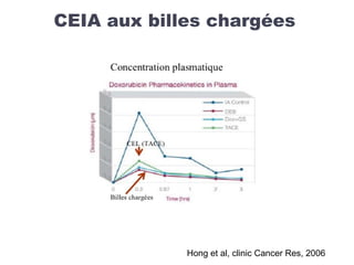 CEIA aux billes chargées
Hong et al, clinic Cancer Res, 2006
 