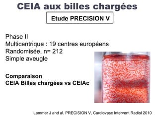 CEIA aux billes chargées
Etude PRECISION V
Phase II
Multicentrique : 19 centres européens
Randomisée, n= 212
Simple aveugle
Comparaison
CEIA Billes chargées vs CEIAc
Lammer J and al. PRECISION V, Cardiovasc Intervent Radiol 2010
 