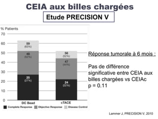 CEIA aux billes chargées
Etude PRECISION V
Lammer J, PRECISION V, 2010
Réponse tumorale à 6 mois :
Pas de différence
significative entre CEIA aux
billes chargées vs CEIAc
p = 0.11
 