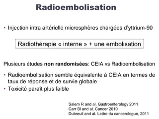 Radioembolisation
• Injection intra artérielle microsphères chargées d’yttrium-90
Plusieurs études non randomisées: CEIA vs Radioembolisation
• Radioembolisation semble équivalente à CEIA en termes de
taux de réponse et de survie globale
• Toxicité paraît plus faible
Salem R and al. Gastroenterology 2011
Carr Bl and al. Cancer 2010
Dubreuil and al. Lettre du cancerologue, 2011
Radiothérapie « interne » + une embolisation
 