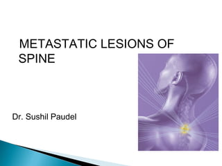 METASTATIC LESIONS OF
SPINE
Dr. Sushil Paudel
 