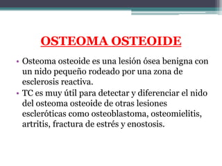 OSTEOMA OSTEOIDE
• Osteoma osteoide es una lesión ósea benigna con
  un nido pequeño rodeado por una zona de
  esclerosis ...
