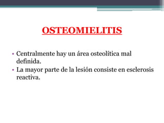 OSTEOMIELITIS

• Centralmente hay un área osteolítica mal
  definida.
• La mayor parte de la lesión consiste en esclerosis...