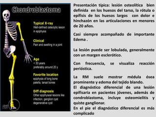 Presentación típica: lesión osteolítica bien
definida en los huesos del tarso, la rótula o
epífisis de los huesos largos c...