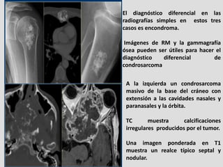El diagnóstico diferencial en las
radiografías simples en estos tres
casos es encondroma.

 Imágenes de RM y la gammagrafí...