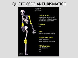 QUISTE ÓSEO ANEURISMÁTICO
 