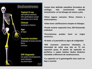 Lesion bien definida osteolítica formadora de
cartílago,   más      comúnmente       ubicada
centralmente en las falanges...