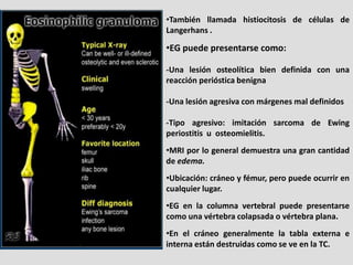 •También llamada histiocitosis de células de
Langerhans .

•EG puede presentarse como:

-Una lesión osteolítica bien defin...