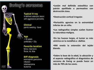 Lesión mal definida osteolítica con
patrón apolillado o permeativo con
destrucción ósea.

Destrucción cortical irregular...