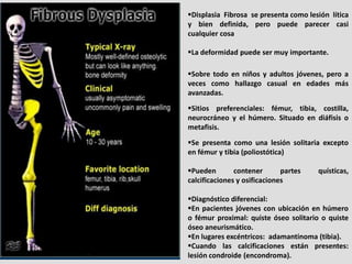 Displasia Fibrosa se presenta como lesión lítica
y bien definida, pero puede parecer casi
cualquier cosa

La deformidad ...