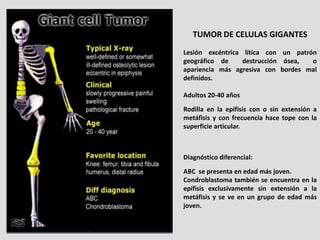 TUMOR DE CELULAS GIGANTES
Lesión excéntrica lítica con un patrón
geográfico de     destrucción ósea,  o
apariencia más agr...