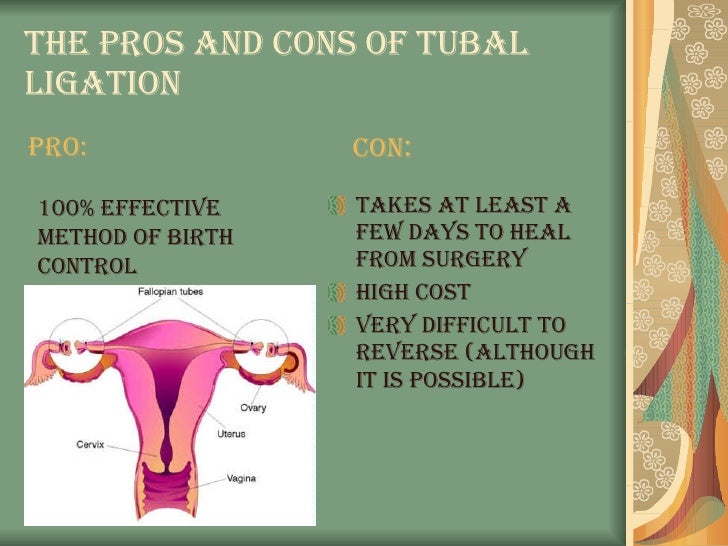 😀 Vasectomy Vs Tubal Ligation Pros Cons The Pros And Cons Of A Vasectomy