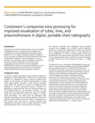 White Paper | CARESTREAM Tube & Line Visualization Software,
CARESTREAM Pneumothorax Visualization Software
Carestream’s companion-view processing for
improved visualization of tubes, lines, and
pneumothoraces in digital, portable chest radiography
Introduction
Carestream has implemented companion views in its digital
radiography systems. A companion view is designed to
complement the standard processed radiographic image
delivered from the digital radiography capture modality to
PACS, to provide an additional rendering tailored for the visual
interpretation needed for a specific diagnostic or clinical
purpose. Two companion views are available in Carestream
products for chest radiography: one for the optimal
visualization of tubes and lines in chest radiographs
(CARESTREAM Tube & Line Visualization Software), and the
other for enhancing the conspicuity of a pneumothorax
(CARESTREAM Pneumothorax Visualization Software).
Companion Views
Carestream’s digital radiography image processing software is
designed to automatically render images with an appearance
suitable for a radiologist to assess a patient’s condition with
respect to the spectrum of potential abnormalities. A single
chest image typically comprises a wide range of exposure
(gray) levels that exceed the number of brightness levels
available on a PACS workstation monitor. Therefore, an
appropriate overall rendering may not necessarily display the
full grayscale fidelity for any particular indication. In other
words, there are simply more gray levels in the raw, captured
image than what the PACS monitor can display in a single,
static presentation. This effect exists for radiologists who
typically read images on high-resolution displays in rooms with
reduced ambient lighting—but the effect is exacerbated for
ICU clinicians who may need to interpret portable chest
radiographs at the point of care, on lower-resolution monitors
under bright light, which is common in the ICU setting.
For instance, a portable chest radiograph may be properly
rendered and displayed with excellent overall diagnostic
quality, yet it may still be challenging to localize tube and line
tips in underpenetrated regions, such as in the mediastinum
and subdiaphragm. In order to preserve global contrast and
brightness for the overall image, gray levels may be quantized
in the underpenetrated regions, which will cause some degree
of detail contrast loss in the mediastinum (Figure 1 – image
on left).
To address this issue, Carestream has developed a unique and
robust image-processing algorithm that specifically highlights
tube and catheter features 1
(CARESTREAM Tube & Line
Visualization Software). To generate the companion view, the
image is first decomposed into eight spatial frequency bands.
These bands are individually manipulated using non-linear
functions designed to achieve an equalized contrast
enhancement of image details, while at the same time
minimizing noise. The manipulated frequency bands are then
reconstructed and the output image is passed through a
grayscale look-up table for display. This method boosts the
spatial frequencies required to enhance the conspicuity of
tubes and lines while it suppresses the spatial frequencies
containing noise. By enhancing the tube and line features
while simultaneously suppressing noise, this method also
works robustly for images captured at low exposure levels and
for images of large patients containing excessive X-ray scatter.
While the companion view presentation may not be suitable
for general diagnostic interpretation, the image features
necessary for interpretation of the tube and line structures are
significantly enhanced (Figure 1 – image on right).
 