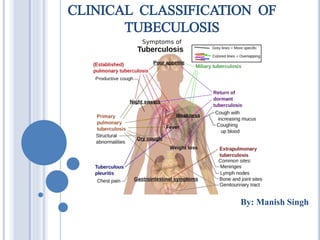 CLINICAL CLASSIFICATION OF
TUBECULOSIS
By: Manish Singh
 