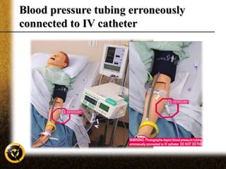 Tube misconnections in critical care | PPT