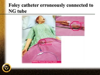 Tube Connection Fail Tube misconnections in critical care | PPT