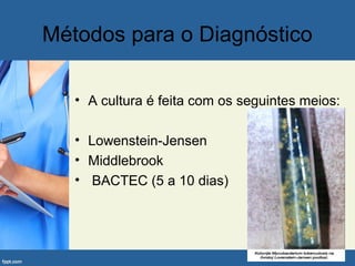Métodos para o Diagnóstico
• A cultura é feita com os seguintes meios:
• Lowenstein-Jensen
• Middlebrook
• BACTEC (5 a 10 dias)
 