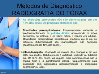Métodos de Diagnóstico
RADIOGRAFIA DO TÓRAX
• As alterações pulmonares não são demonstradas em até
15% dos casos. As principais alterações são:
• Opacidades parenquimatosas: frequentemente unifocais e
predominantemente no pulmão direito, acometendo os lobos
superiores na infância e os lobos médio e inferior em adultos.
Opacidades arredondadas persistentes, medindo até 3 cm de
diâmetro (tuberculomas) são manifestações não habituais
(descritas em até 10% dos casos).
• Linfonodomegalia: observada na maioria das crianças e em até
40% dos adultos. Habitualmente é unilateral, podendo ser bilateral
em até 30% dos casos. As regiões mais comprometidas são a
região hilar e a paratraqueal direita. Frequentemente está
associada com opacidades parenquimatosas e atelectasia
segmentar ou lobar.
 