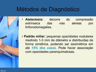 Métodos de Diagnóstico
• Atelectasia: decorre da compressão
extrínseca das vias aéreas por
linfonodomegalias.
• Padrão miliar: pequenas opacidades nodulares
medindo 1-3 mm de diâmetro e distribuídas de
forma simétrica, podendo ser assimétrica em
até 15% dos casos. Pode haver associação
com opacidades parenquimatosas.
 
