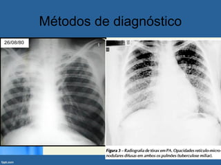 Métodos de diagnóstico
 