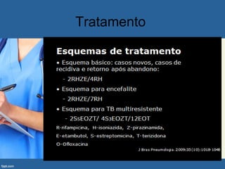 Tratamento
 