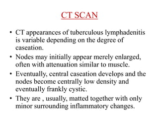 CT SCAN
• CT appearances of tuberculous lymphadenitis
is variable depending on the degree of
caseation.
• Nodes may initially appear merely enlarged,
often with attenuation similar to muscle.
• Eventually, central caseation develops and the
nodes become centrally low density and
eventually frankly cystic.
• They are , usually, matted together with only
minor surrounding inflammatory changes.
 