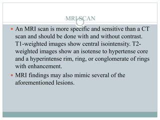 MRI SCAN
 An MRI scan is more specific and sensitive than a CT
scan and should be done with and without contrast.
T1-weighted images show central isointensity. T2-
weighted images show an isotense to hypertense core
and a hyperintense rim, ring, or conglomerate of rings
with enhancement.
 MRI findings may also mimic several of the
aforementioned lesions.
 