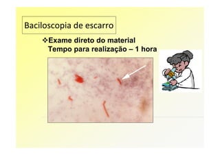Baciloscopia de escarro
      Exame direto do material
      Tempo para realização – 1 hora
 