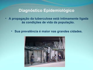Diagnóstico Epidemiológico A propagação da tuberculose está intimamente ligada às condições de vida da população.  Sua prevalência é maior nas grandes cidades. 