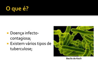    Doença infecto-
    contagiosa;
   Existem vários tipos de
    tuberculose;

                              Bacilo de Koch
 