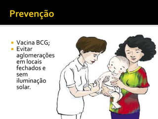    Vacina BCG;
   Evitar
    aglomerações
    em locais
    fechados e
    sem
    iluminação
    solar.
 
