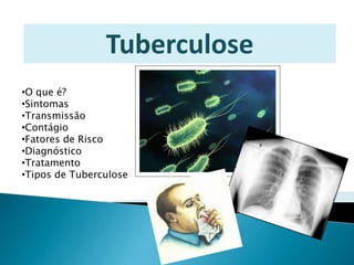 Tuberculose
•O que é?
•Sintomas
•Transmissão
•Contágio
•Fatores de Risco
•Diagnóstico
•Tratamento
•Tipos de Tuberculose
 