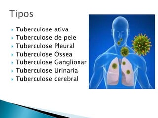  Tuberculose ativa
 Tuberculose de pele
 Tuberculose Pleural
 Tuberculose Óssea
 Tuberculose Ganglionar
 Tuberculose Urinaria
 Tuberculose cerebral
 