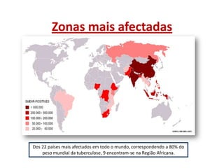 Zonas mais afectadas

Dos 22 países mais afectados em todo o mundo, correspondendo a 80% do
peso mundial da tuberculose, 9 encontram-se na Região Africana.

 